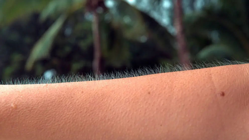 Goosebumps Raising Hair